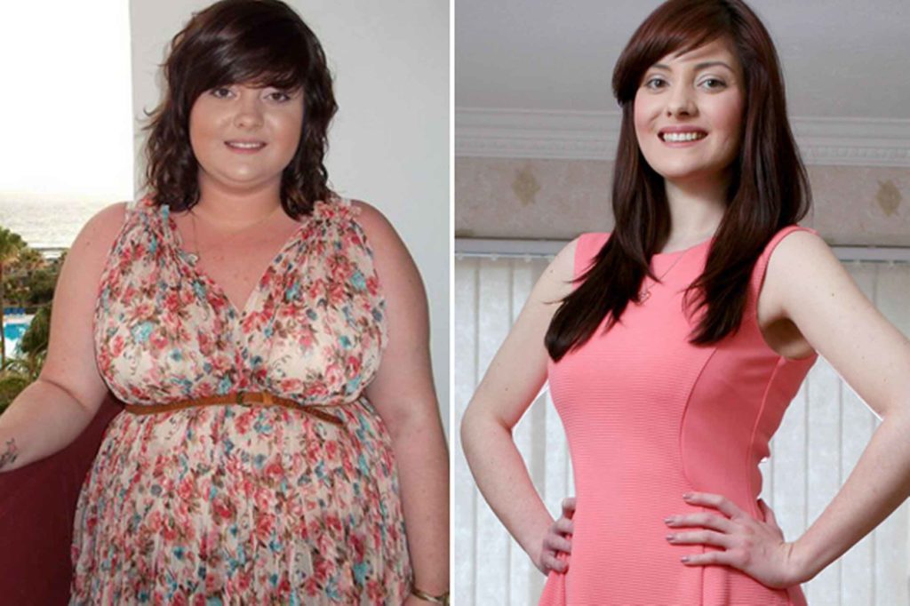 Weightloss-woman-after-before