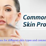 Home remedies for different skin types and common skin issues