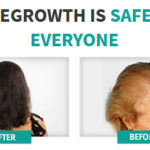 Magnetique Hair Growth before after