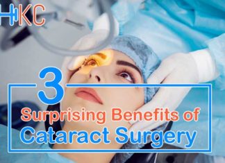 Benefits of Cataract Surgery