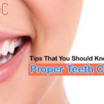 Teeth Care tips