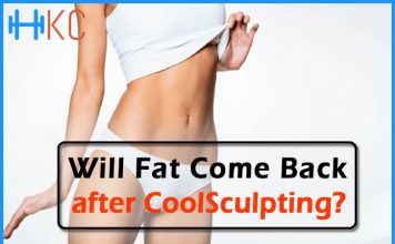 CoolSculpting