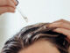 Castor Oil For Postpartum Hair Issues